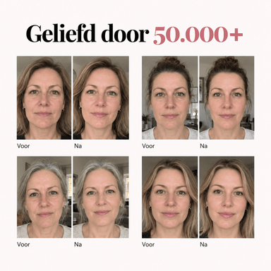 Hair ID Spray - maakt donshaar zichtbaar