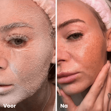 Hair ID Spray - maakt donshaar zichtbaar
