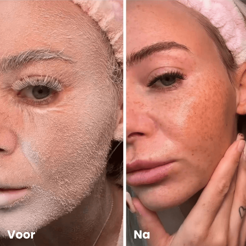 Hair ID Spray - maakt donshaar zichtbaar